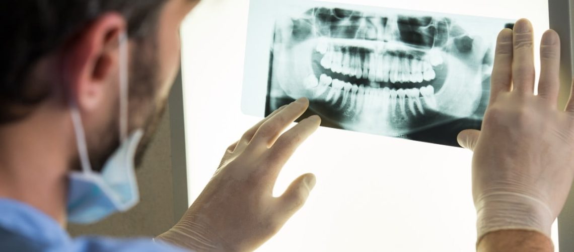 What Should I do About My Periodontal Pockets?
