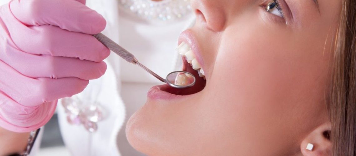Dental Descaling- When Do You Need It?