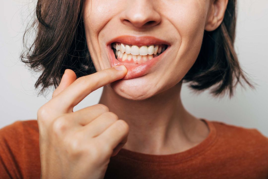 How Low Magnesium Levels Contribute to Tooth Grinding